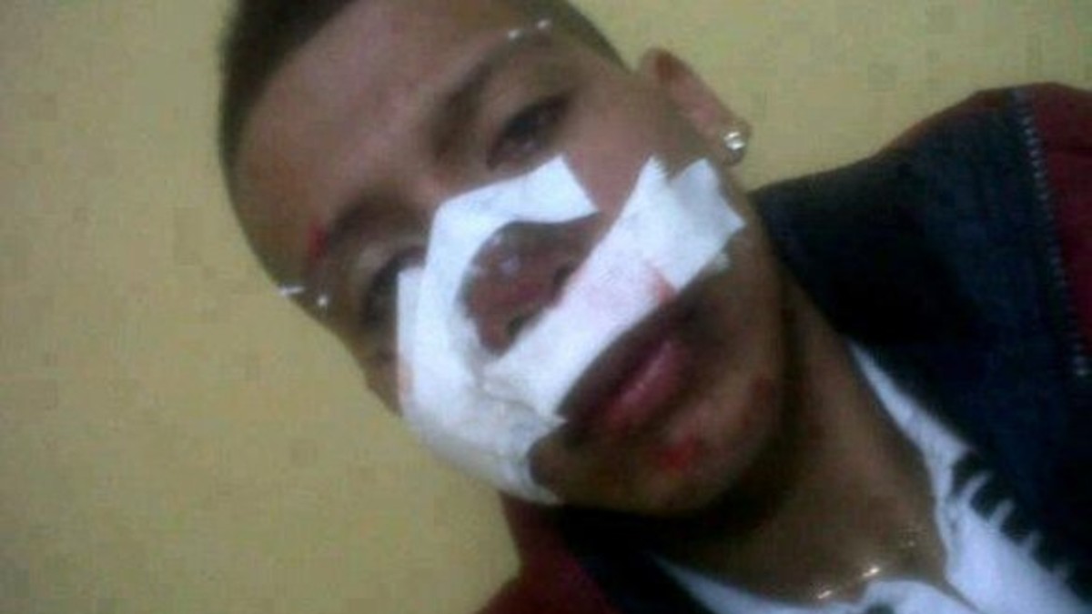 Wachiturro terminó en el hospital con la cara rota