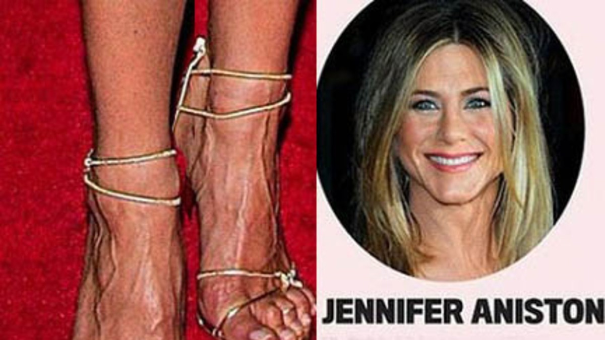 Pies feos: famosas que son bellas de la cabeza hasta los tobillos