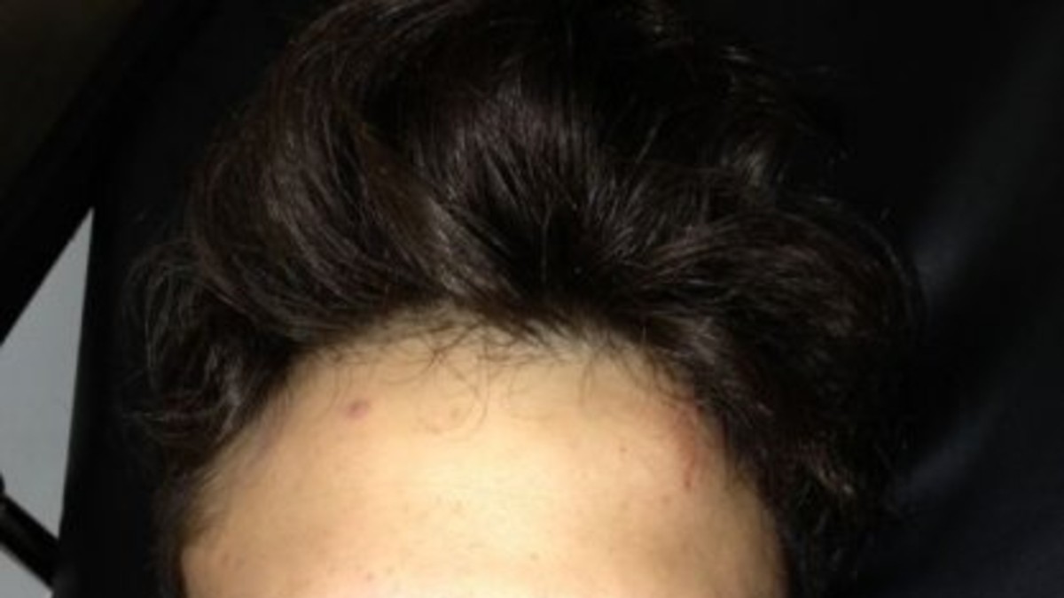 Dieron una paliza a pareja gay por besarse en público