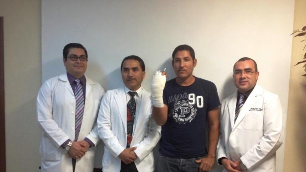 Se amputó la mano para cobrar 2 millones de euros