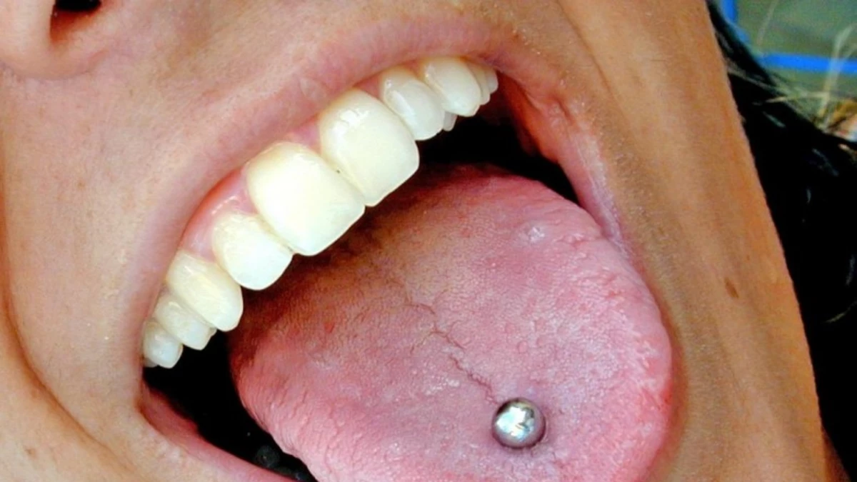 Malos hábitos y complicaciones del piercing bucal