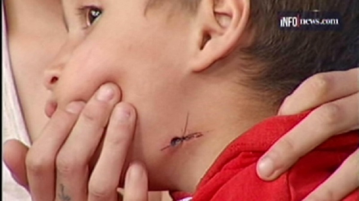 La policía de Tigre baleó en el cuello a un nene de 4 años
