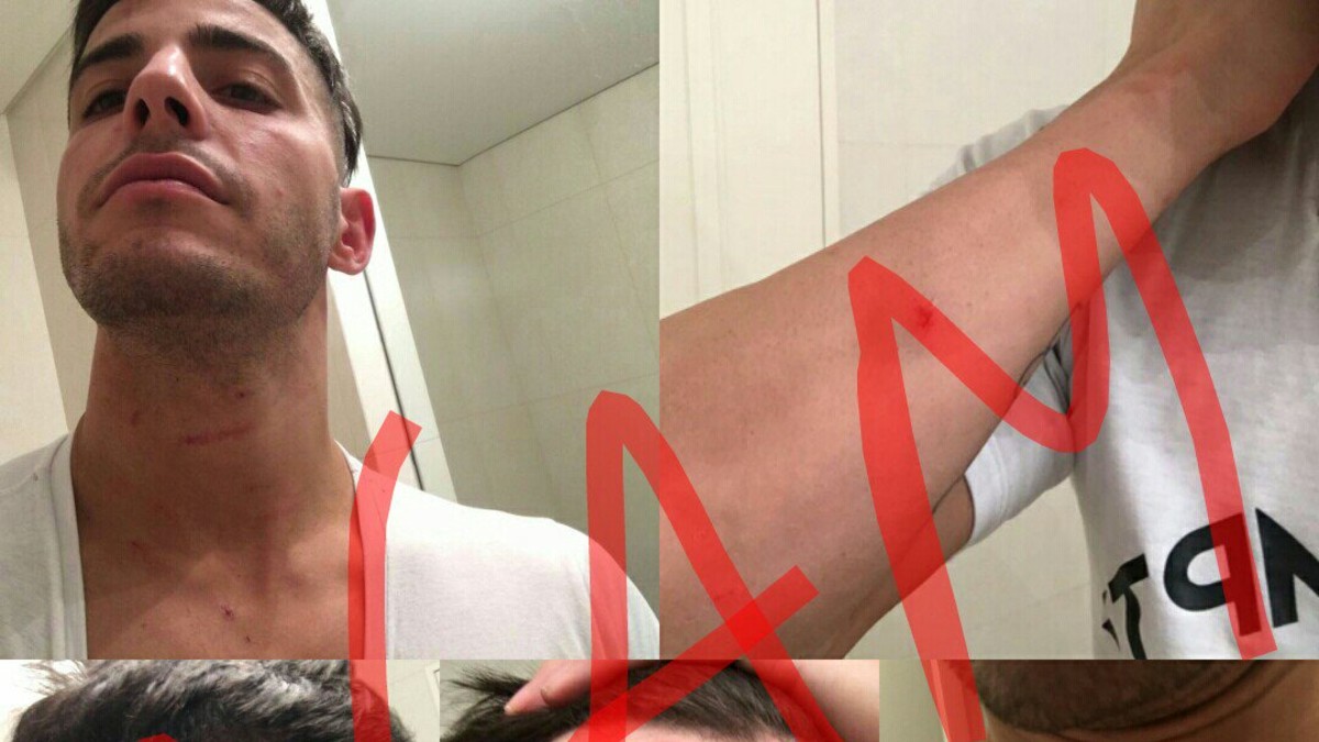 Ahora Lhoan se mostró "golpeado" por Charlotte