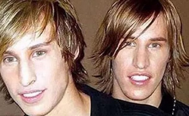 Gastaron miles en parecerse a Brad Pitt y así quedaron- Gastaron miles en parecerse a Brad Pitt y así quedaron