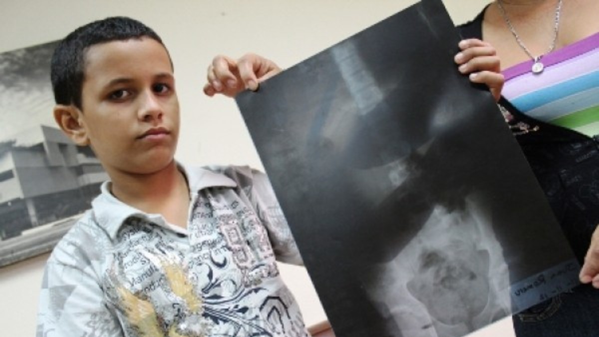 Apareció la cara de un médico muerto en una radiografía