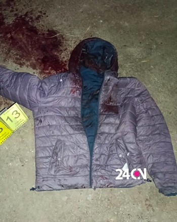 Policía defendió a una familia, mató a dos ladrones y recibió tres tiros