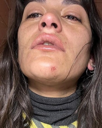 Golpeó a su novia, le sacó el celular para revisar con qué hombres hablaba y le borró sus contactos 
